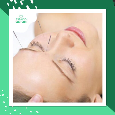 ACUPUNTURA ESTÉTICA FACIAL
